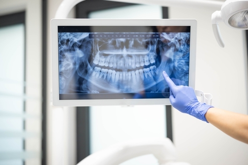Cirugía Oral en Scranton, PA | Reserve una Consulta Gratuita Hoy