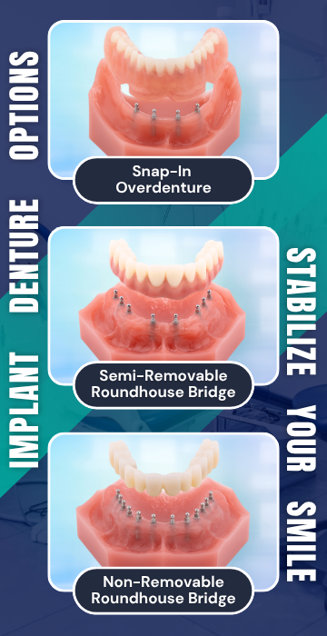 Implant Denture Options in Scranton, PA | Mini Dental Implants | Book a Free Consultation