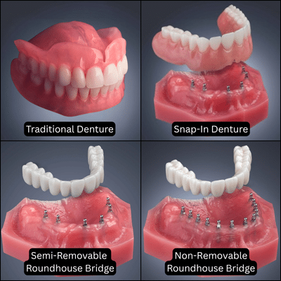 4 Denture Options in Scranton, PA | Free Implant Denture Consults